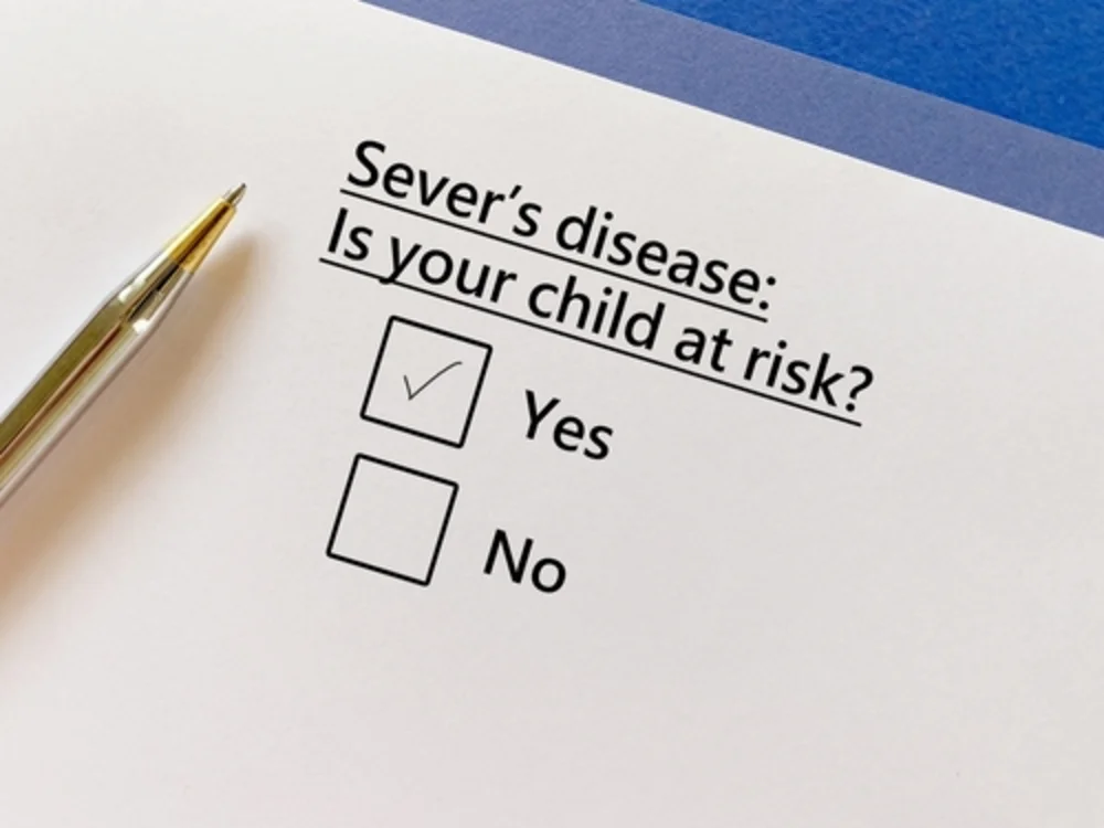 severs disease treatments wimbledon london