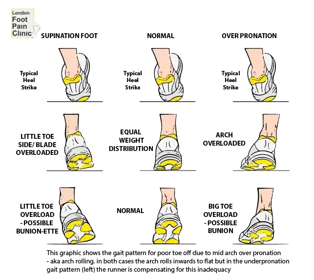 Find Your Footstrike Pattern